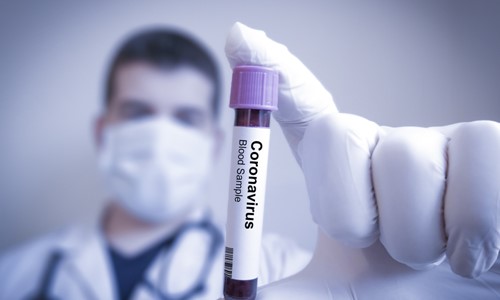 The RBA Has Slashed Interest Rates In Response To The Coronavirus